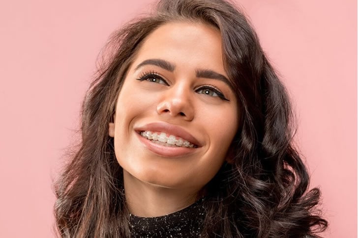 Affordable Braces: Boost Dental Health and Confidence