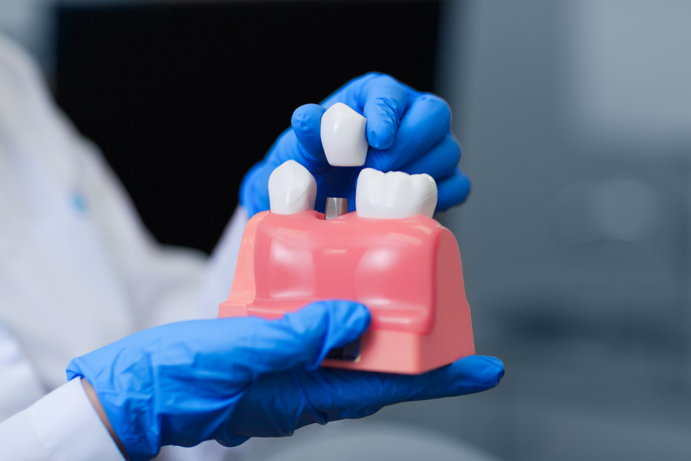 Your Path to Affordable Dental Implants